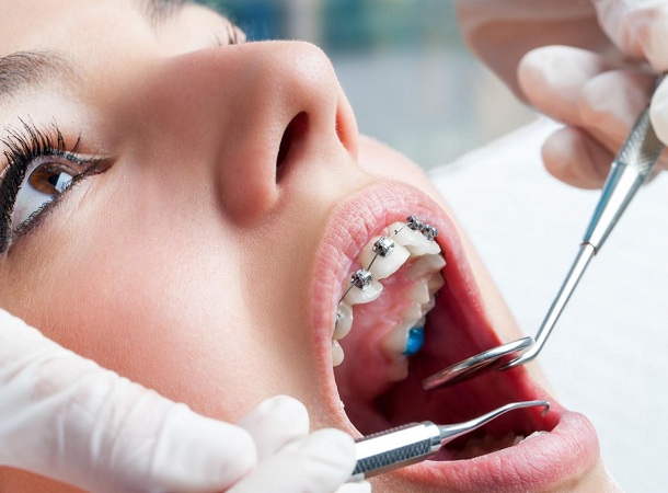 Orthodontist Melbourne
